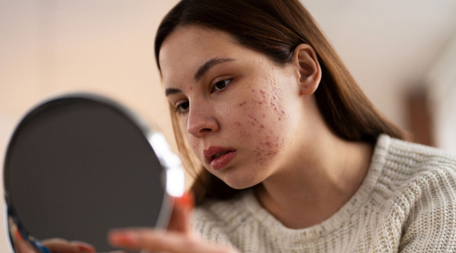 Woman with acne wonders if she should apply a charcoal jelly mask